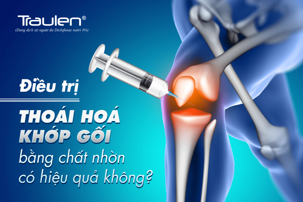 Điều trị thoái hoá khớp gối bằng chất nhờn có hiệu quả không? 13 joint kness min