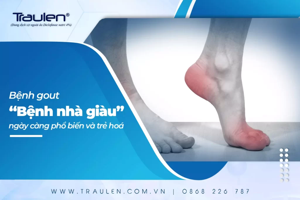 Bệnh gout - “Bệnh nhà giàu” ngày càng phổ biến và trẻ hoá 19 benh gout benh nha giau banner