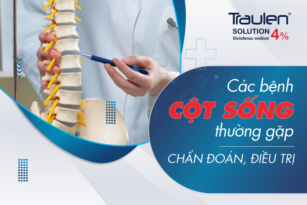 Các bệnh cột sống thường gặp: Chẩn đoán, điều trị, phòng ngừa 40 cac benh cot song thuong gap baner