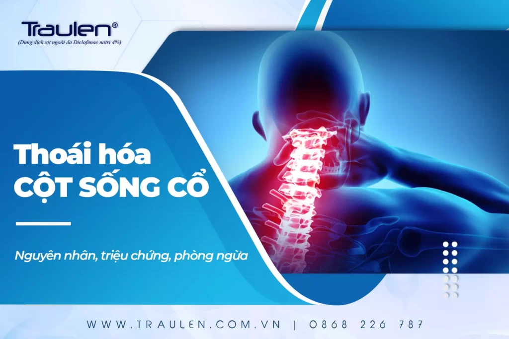Thoái hoá đốt sống cổ: Nguyên nhân, triệu chứng, phòng ngừa 22 thoai hoa cot song co banner min