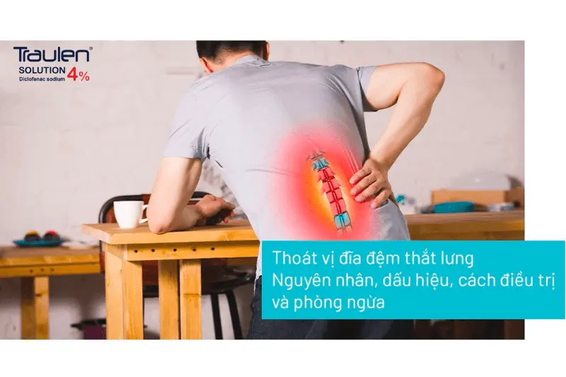 thoát vị đĩa đệm cột sống thắt lưng
