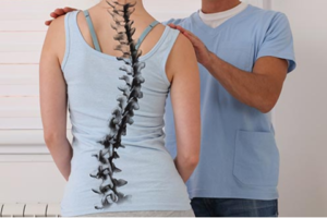 Vẹo cột sống là tình trạng độ cong ngang của cột sống vượt quá mức thông thường, thường xuyên xuất hiện trong giai đoạn tăng trưởng mạnh mẽ của xương cột sống