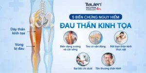 dau than kinh toa 1