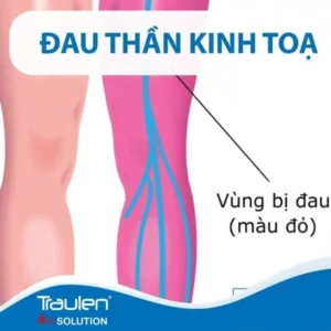 dau than kinh toa 2