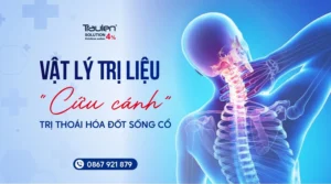 thoai hoa dot song co 1