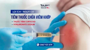 viem khop 1