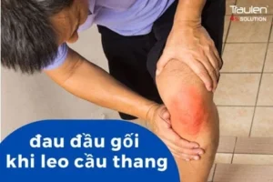 dau dau goi