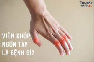 dau khop ngon tay cai