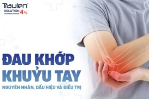 dau nhuc khop khuyu tay