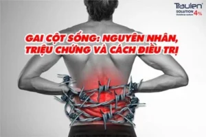 gai cot song 1