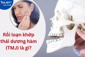 roi loan khop thai duong ham
