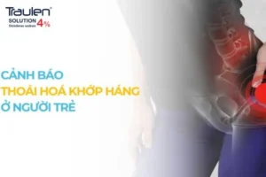 thoai hoa khop hang 1