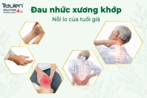 viem khop