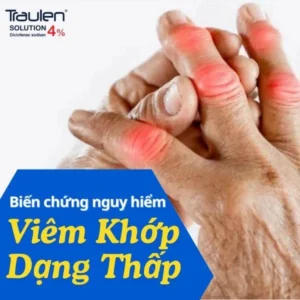 viem khop dang thap