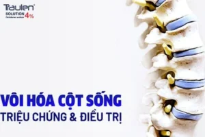 voi hoa cot song