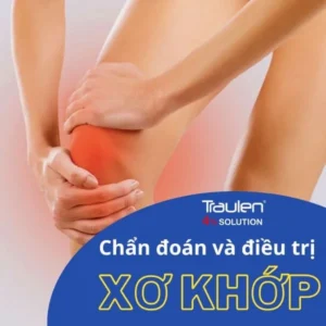 xo khop