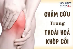 cham cuu