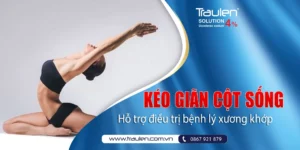 keo gian cot song 2
