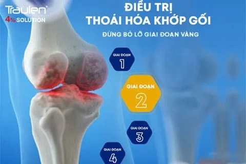 thoai hoa khop goi 2