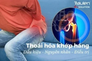 thoai hoa khop hang