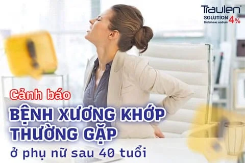 Cảnh báo những bệnh xương khớp thường gặp ở phụ nữ sau 40 tuổi 16 xuong khop 1