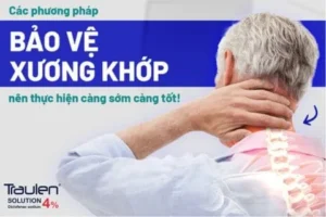 xuong khop