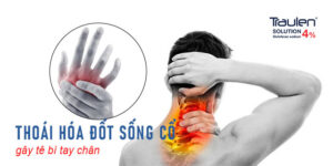 thoai hoa cot song co 2