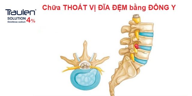 thoat vi dia dem dong y