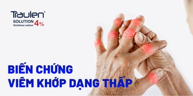 viem khop dang khop