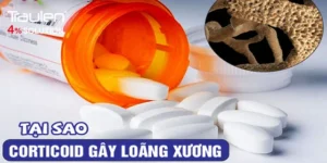 loang xuong corticoid