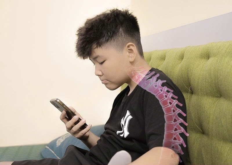 Text Neck là tình trạng đau mỏi và biến dạng cột sống do thói quen cúi đầu dùng điện thoại hoặc máy tính trong thời gian dài