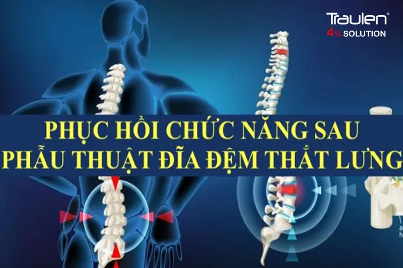 Phục hồi chức năng đóng vai trò then chốt trong việc tối ưu hóa kết quả điều trị sau phẫu thuật thoát vị đĩa đệm