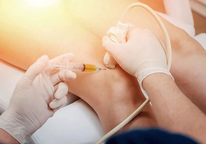 Tế bào gốc điều trị thoái hóa khớp gối: Giải pháp tiên phong cho cuộc sống không đau từ y học tái tạo 6 Bệnh nhân điều trị thoái hóa khớp gối bằng tế bào gốc phục hồi rất nhanh
